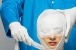 11 biến chứng nguy hiểm sau khi phẫu thuật thẩm mỹ