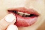 9 thực phẩm trị khô nẻ môi mùa lạnh