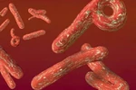Phòng tránh virus Ebola bằng cách nào?