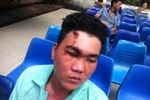 Tạm đình chỉ một chiến sỹ vụ nghi hư mắt vì trúng gậy của cảnh sát