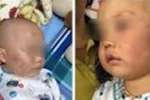 Tạm đình chỉ công tác bảo mẫu tát sưng má bé trai 19 tháng tuổi