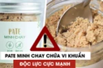 Bác sĩ tư vấn cách tránh ngộ độc thực phẩm do độc tố botulinum