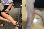 Có cần giáo dục cô giáo Trang, cô Vân ở Quán Toan nữa không?