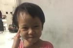 Bé Phước An mong được phẫu thuật tìm lại bàn tay