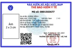 Sẵn sàng cho công tác cấp thẻ Bảo hiểm y tế mẫu mới từ ngày 01/4/2021