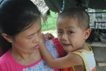 Bé trai 4 tuổi đau đớn chống chọi bênh ung thư máu vì không có tiền 