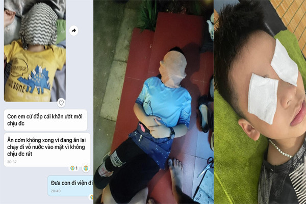 Nhiều trường hợp bị rát da mặt, mắt nên phải đắp khăn mặt ướt. (Ảnh: Phụ huynh cung cấp) gdvn_hoc-sinh-th-hai-boi-bi-di-ung-thuoc-muoi 333.jpg