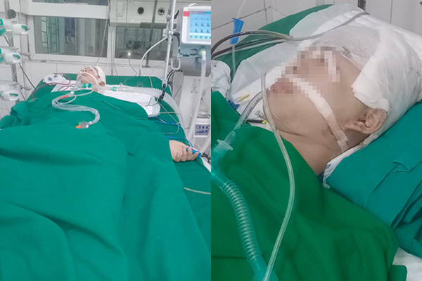 Hình ảnh cháu B. vẫn trong trạng thái hôn mê. Về phía gia đình của những học sinh có liên quan hành hung cháu B. cũng đã đến bệnh viện thăm hỏi cháu.(Ảnh: gia đình cung cấp)