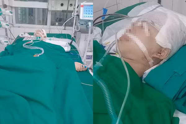 Hình ảnh cháu B. vẫn trong trạng thái hôn mê. Về phía gia đình của những học sinh có liên quan hành hung cháu B. cũng đã đến bệnh viện thăm hỏi cháu.(Ảnh: gia đình cung cấp) Hình ảnh cháu B. vẫn trong trạng thái hôn mê. Về phía gia đình của những học sinh có liên quan hành hung cháu B. cũng đã đến bệnh viện thăm hỏi cháu.(Ảnh: gia đình cung cấp)