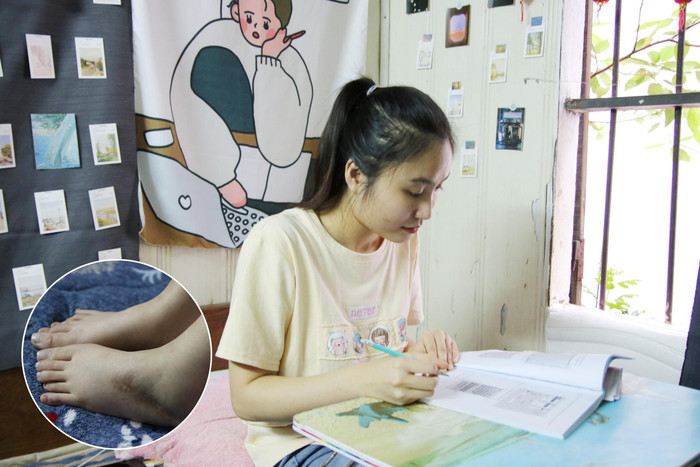 Hương Giang chăm chỉ học tập, nỗ lực bước đi bằng đôi chân của chính mình (Ảnh: Phạm Minh) Hương Giang chăm chỉ học tập, nỗ lực bước đi bằng đôi chân của chính mình (Ảnh: Phạm Minh)