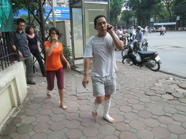 Hai người dân bị thương nhẹă, trong đó có một cô gái trẻ bước ra từ cuộc hỏa hoạn. Hai người dân bị thương nhẹă, trong đó có một cô gái trẻ bước ra từ cuộc hỏa hoạn.