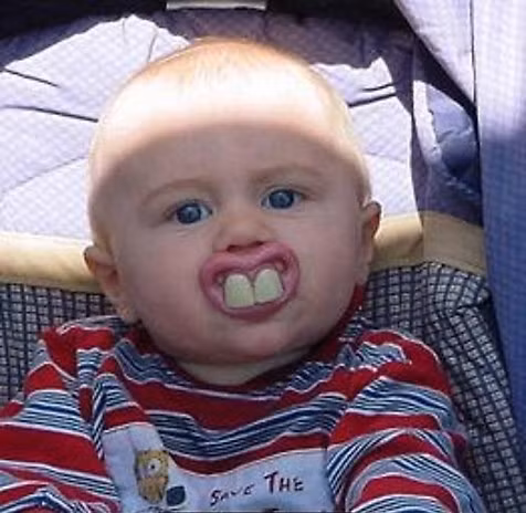 "Môi hở răng..hô"