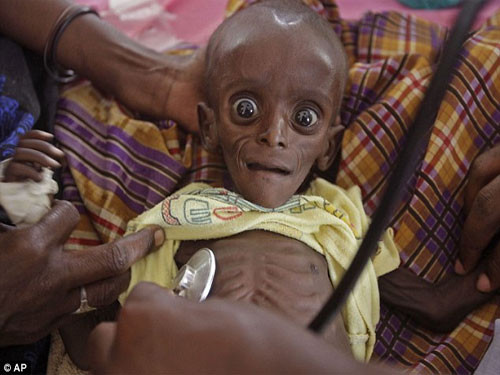 Hình ảnh khiến cư dân mạng rớt nước mắt về nạn đói đang hoành hành ở Châu Phi. Trẻ em luôn là đối tượng đáng thương nhất khi có dịch bệnh, chiến tranh, tai ương...