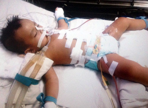 Bé Phụng bị đâm 9 nhát trên người còn hôn mê. Ảnh: Gia đình cung cấp. Bé Phụng bị đâm 9 nhát trên người còn hôn mê. Ảnh: Gia đình cung cấp.