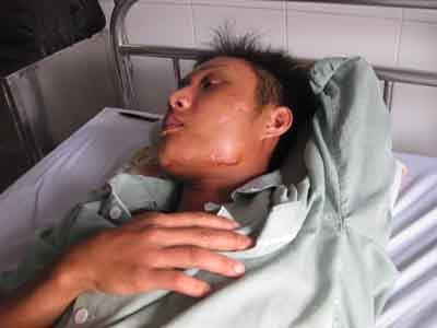 Một nạn nhân bị băng nhóm Dũng Phương đánh phải nhập viện. Một nạn nhân bị băng nhóm Dũng Phương đánh phải nhập viện.