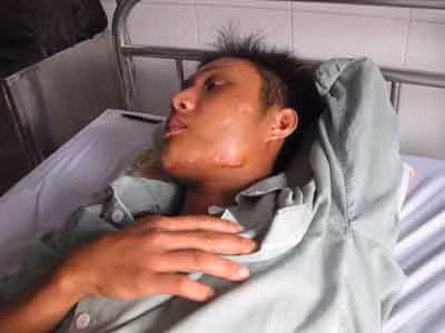 Một nạn nhân bị băng nhóm Dũng Phương đánh phải nhập viện.