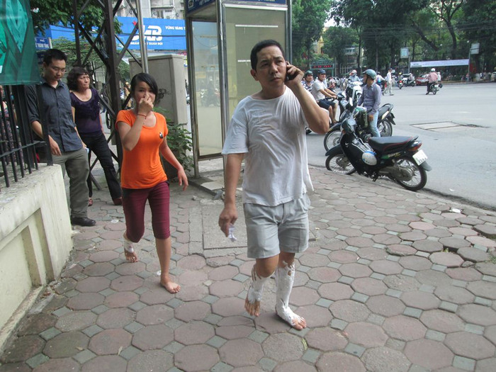 Một người dân bị thương