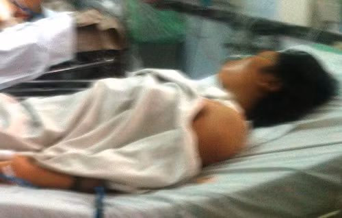 Chị Trần Thị Thanh Huyền cấp cứu tại bệnh viện 175