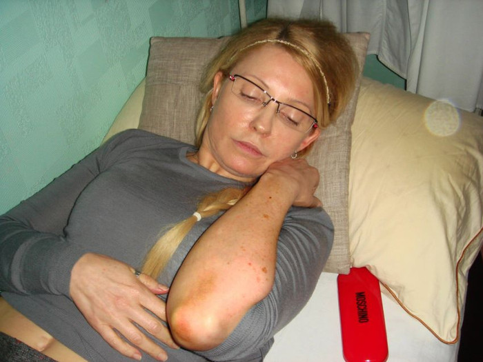 Và lúc trên giường bệnh trong nhà tù