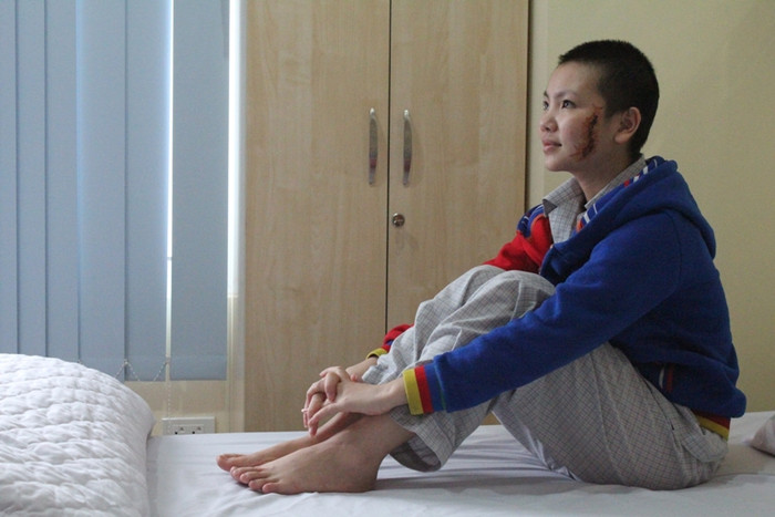 Sau một thời gian điều trị ở Hà Nội thì G đã lạc quan hơn!