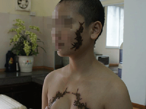 Nguyễn Thị G. với những hình xăm trên cơ thể