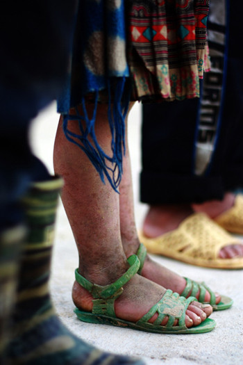 Những bàn chân không tất, không giầy, khô đi và nứt nẻ… Những bàn chân không tất, không giầy, khô đi và nứt nẻ…