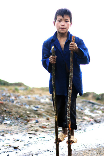 (Phong phanh với chiếc áo sơ mi trơ chọi 1 chiếc cúc). Đây là những hình ảnh tôi vừa chụp được về những em bé vùng biên giới thuộc 3 bản tái định cư vì sạt lở đất gồm Căng Ký, Căng Há, Khấu Giào, thuộc xã Tung Qua Lìn, huyện Phong Thổ, tỉnh Lai Châu. Thật thương cảm và xót xa cho cuộc sống khốn khó của các em. (Phong phanh với chiếc áo sơ mi trơ chọi 1 chiếc cúc). Đây là những hình ảnh tôi vừa chụp được về những em bé vùng biên giới thuộc 3 bản tái định cư vì sạt lở đất gồm Căng Ký, Căng Há, Khấu Giào, thuộc xã Tung Qua Lìn, huyện Phong Thổ, tỉnh Lai Châu. Thật thương cảm và xót xa cho cuộc sống khốn khó của các em.