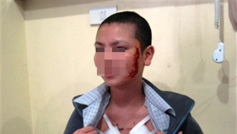 G. chỉ biết cúi gầm xuống. Kế bên, bà chủ vẫn lồng lộn như con thú hoang bị đâm trúng cổ. Vừa chửi chồng, bà vừa lao vào G. mà đấm đá, chửi rủa. G chỉ biết cúi xuống, dùng tay che kín mặt rồi quỳ xuống van xin: con lạy cô, cô tha cho con, con không có làm chuyện đó. G. chỉ biết cúi gầm xuống. Kế bên, bà chủ vẫn lồng lộn như con thú hoang bị đâm trúng cổ. Vừa chửi chồng, bà vừa lao vào G. mà đấm đá, chửi rủa. G chỉ biết cúi xuống, dùng tay che kín mặt rồi quỳ xuống van xin: con lạy cô, cô tha cho con, con không có làm chuyện đó.