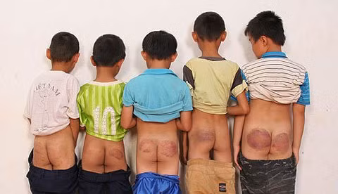 HS Trường tiểu học Phước Sơn (Bình Phước) bị thầy giáo thể dục dùng cây thước gỗ (chiều dài 75 cm, rộng khoảng 4 cm, dày 2 cm) đánh liên tiếp vào mông các em. Ảnh gia đình cung cấp.