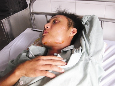 Nạn nhân một vụ thanh toán của giới giang hồ đất Mỏ. Nạn nhân một vụ thanh toán của giới giang hồ đất Mỏ.