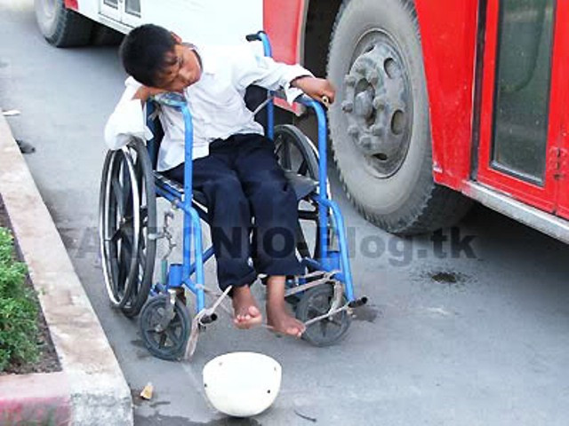 Cậu bé tàn tận gục đầu cam chịu trên xe lăn, trước mặt là cái nắp nhựa để xin tiền (Ảnh Bạn đọc)