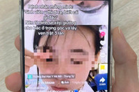 Trường ĐH Y Hà Nội sẽ kỷ luật nghiêm nữ sinh "dọa" lấy ven cho bệnh nhân trật 3 lần