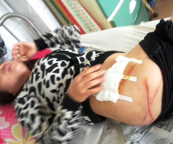 Chị Vân điều trị tại BV Đa khoa tỉnh Gia Lai. Chị Vân điều trị tại BV Đa khoa tỉnh Gia Lai.