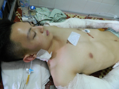 Một trong ba nạn nhân đang điều trị tại bệnh viên Một trong ba nạn nhân đang điều trị tại bệnh viên