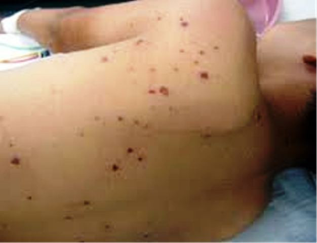 Anh Trần Như Mạnh đang cấp cứu tại Bệnh viện đa khoa huyện Đăk Đoa Anh Trần Như Mạnh đang cấp cứu tại Bệnh viện đa khoa huyện Đăk Đoa