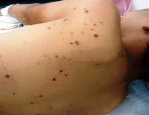 Anh Trần Như Mạnh đang cấp cứu tại Bệnh viện đa khoa huyện Đăk Đoa