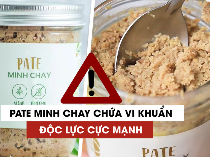 Đề cập đến ngộ độc thực phẩm do độc tố botulinum, bác sĩ Nguyễn Trung Nguyên, Giám đốc Trung tâm Chống độc (Bệnh viện Bạch Mai) cho biết, đây là loại ngộ độc kinh điển trong y văn. Ảnh minh họa: TD. Đề cập đến ngộ độc thực phẩm do độc tố botulinum, bác sĩ Nguyễn Trung Nguyên, Giám đốc Trung tâm Chống độc (Bệnh viện Bạch Mai) cho biết, đây là loại ngộ độc kinh điển trong y văn. Ảnh minh họa: TD.