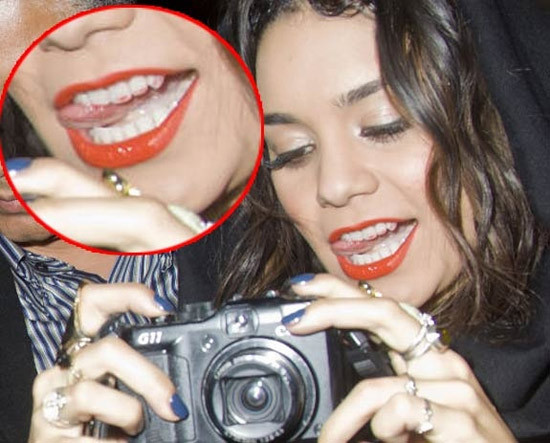 Môi son quá đậm lem cả vào răng làm Vanessa Hudgens xấu tệ. Xem thêm: Nghệ thuật chưng diện "màn hình phẳng" của Sao Hoa ngữ