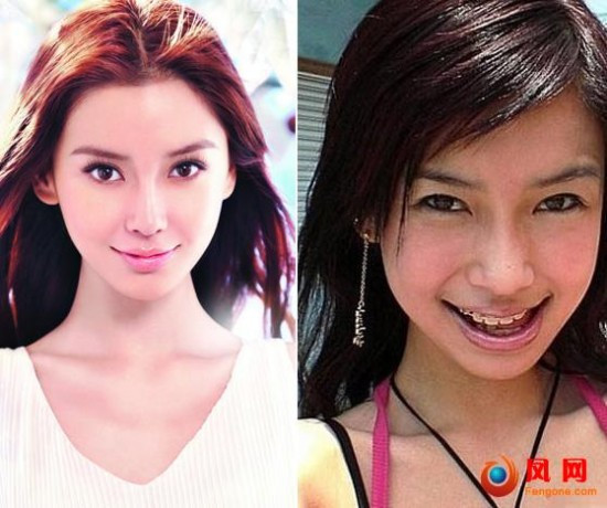 Siêu mẫu Angelababy, người tình của Huỳnh Hiểu Minh với hàm răng niềng "hấp dẫn".