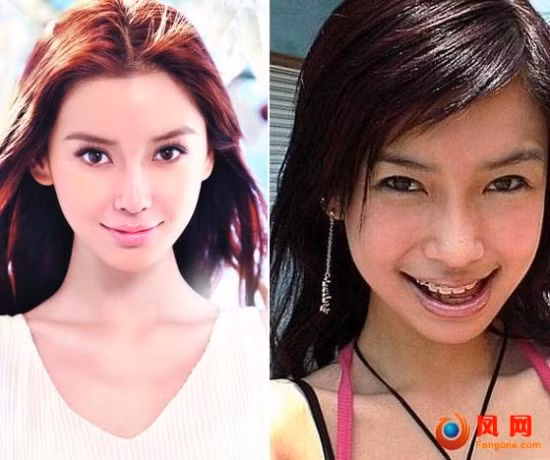 Siêu mẫu Angelababy, người tình của Huỳnh Hiểu Minh với hàm răng niềng "hấp dẫn".