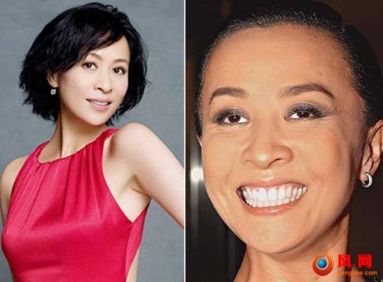 Lưu Gia Linh hết cỡ với hàm răng trắng bóc nhưng mặt không phẳng phiu như khi trang điểm.