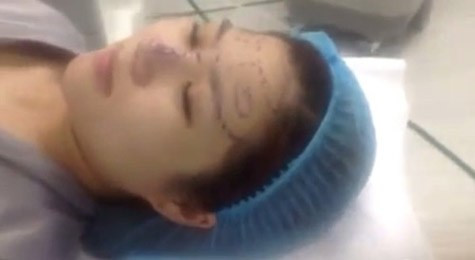 Hình ảnh Hương Tràm trong phòng phẫu thuật Hình ảnh Hương Tràm trong phòng phẫu thuật