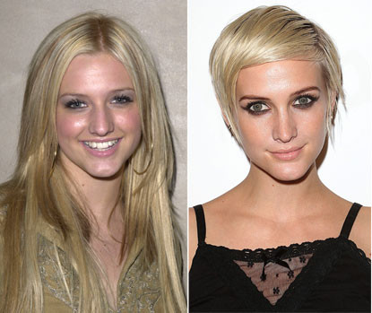 Ca sĩ Ashlee Simpson chỉnh mũi năm 2006 khi cô 21 tuổi, khiến gương mặt cô thay đổi rất nhiều. Xem thêm: Điểm danh những chiếc cằm mới của Sao Việt