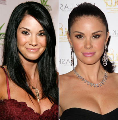 Jayde Nicole, người mẫu nóng bỏng của tạp chí Playboy cũng thay đổi khuôn mặt đáng kể từ năm 2008 đến nay, dù cô chưa bao giờ thừa nhận đụng tới dao kéo. Xem thêm: Điểm danh những chiếc cằm mới của Sao Việt