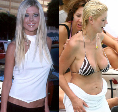 Nữ diễn viên Tara Reid trở thành sao trẻ nóng bỏng từ bộ phim "American Pie" năm 2001. Nhưng sau đó, người đẹp này lại tự biến mình thành thảm họa phẫu thuật với cơ thể chảy xệ xấu xí. Xem thêm: Điểm danh những chiếc cằm mới của Sao Việt