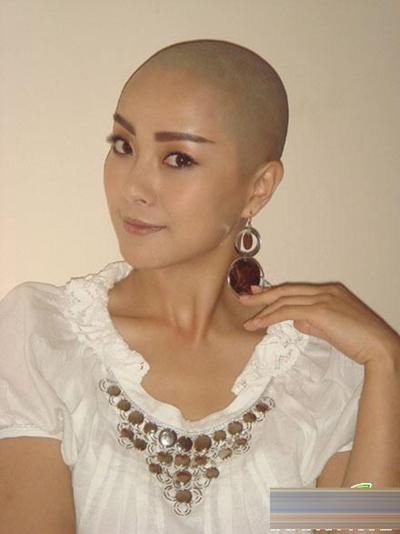 Tô Nham trọc đầu để vào phim “Mỹ nhân đầu trọc”. Tô Nham trọc đầu để vào phim “Mỹ nhân đầu trọc”.