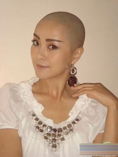 Tô Nham trọc đầu để vào phim “Mỹ nhân đầu trọc”. Tô Nham trọc đầu để vào phim “Mỹ nhân đầu trọc”.