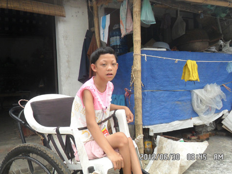 Nỗi bất hạnh đeo bám lên cuộc đời bé Lan trong suốt 12 năm qua. Nỗi bất hạnh đeo bám lên cuộc đời bé Lan trong suốt 12 năm qua.