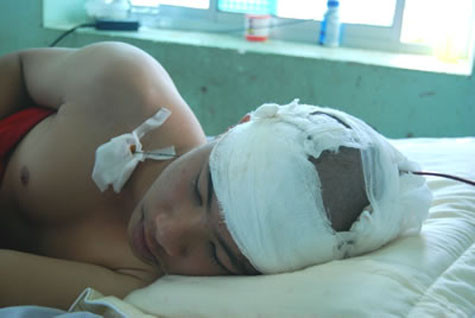 Em Nguyễn Hùng Cường vừa được phẫu thuật nên tạm thời qua cơn nguy kịch.