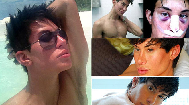 Anh chàng búp bê Justin Jedlica đã phải chịu những đau đớn về thể xác để có ngoại hình búp bê như ý muốn.